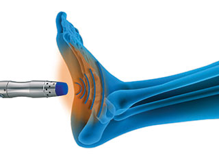 zimmer shockwave therapy machine perform